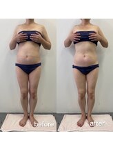 キアラ(chiara)/ 50代２ヶ月後