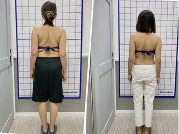 リスタート整体院 鹿児島(Restart整体院)/Restart痩身&ダイエット