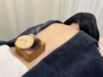 番町もくの木鍼灸院/升灸　腰部施術