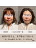 【猫背・巻き肩が気になる方へ】人気NO.2*小顔矯正+巻き肩改善90分 ¥24200→