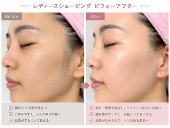 まつげエクステ キオク 人形町(kioku)の写真/【完全個室☆毛穴お顔剃りシェービング】レディースシェービング/お顔剃り