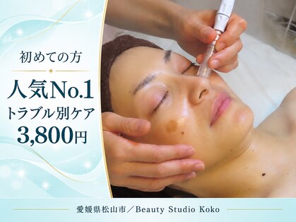 ココ(Koko)の写真