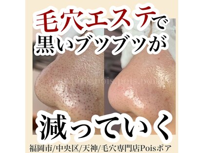 ポア(Pois)の写真