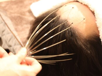 アジオ 三ノ宮駅前店(AGIO)/ヘッド