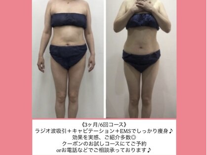 隠れ家サロンキララ(kirara)の写真