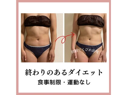 ヨサパーク カリーナ(YOSA PARK carina)の写真