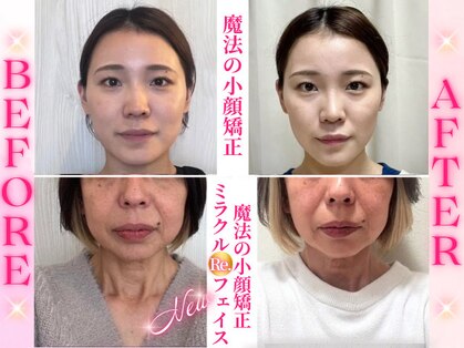 ハッピービューティーサロン じゆう(Happy Beauty Salon J∞YOU)の写真