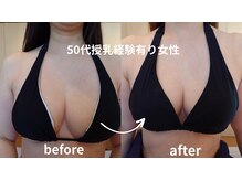 サロンハナ(Salon HANA)の雰囲気（サイズアップだけでなく腕周りや脇のスッキリ感がわかります）