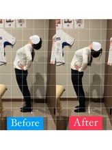 ナオル整体 宮崎院(NAORU整体)/30代女性施術事例【反り腰改善】