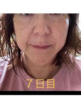 セントセシリア/GUINOT　VARの効果！7日目