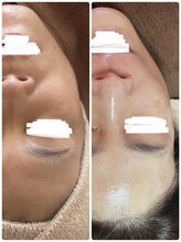 サロンニーナ(Salon.Nina)/韓国肌管理セルマン