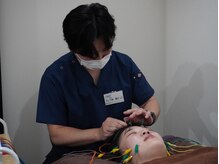 リベルタ鍼灸整骨院 なんば店(Liberta鍼灸整骨院)/美容鍼/食いしばり・眼精疲労に!