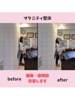 心斎橋長堀フェムテック整骨院/大阪 心斎橋 本町 難波 整体