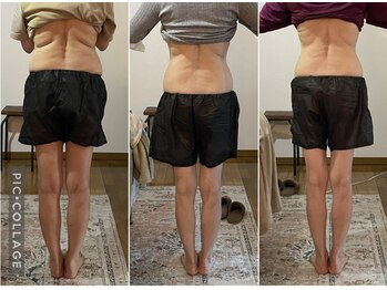 しあわせ腸研究所/腸もみbefore & after