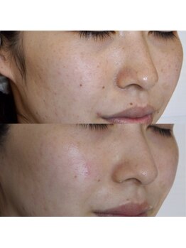 ザ シー タイムレスビューティ(THE SHE)/30代お客様症例写真