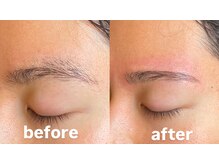 トップルック 横浜店(TOP LOOK)/メンズ眉毛ビフォーアフター