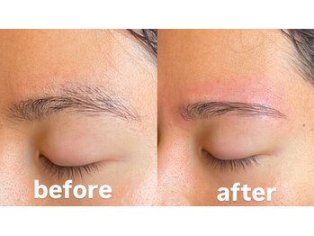 トップルック 横浜店(TOP LOOK)/メンズ眉毛ビフォーアフター
