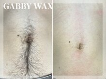 ギャビーワックス(GABBY WAX)/☆ギャンドゥー脱毛☆