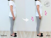 エーアール(AR)/【Before/After】