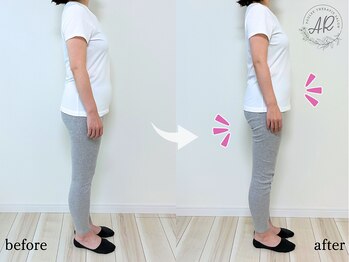 エーアール(AR)/【Before/After】