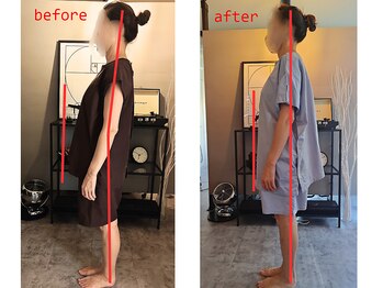 ヴェリタス(VERITAS)の写真/なんとなく重い、だるい。揉んでも治らない頭痛は歪みが原因かも？筋膜を整えたるまずスリムな体にサイズ↓