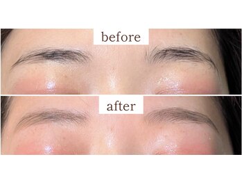 ヒビキ(Hibiki)/HBL before→after