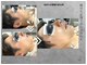 ル シャの写真/完全予約制・貸切サロン!美肌になりながらヒゲ脱毛が可能！