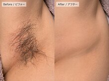 プレシャス(Precious)の雰囲気（四日市脱毛/産毛ケア/毛穴ケア/ツヤ肌/肌質改善/四日市エステ）