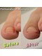 ニコルル 富田林店(Nicolulu)の写真/巻き爪のお悩みをサポート！アロマオイル保湿付きフットケア　新規　￥12800→￥10000