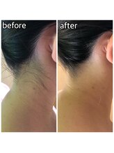 パーソナルエステティックサロン リボーン(ReBorn)/