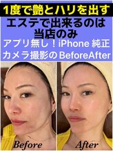 スペチアーレ 夙川/ピーリングは古い!最新マシン