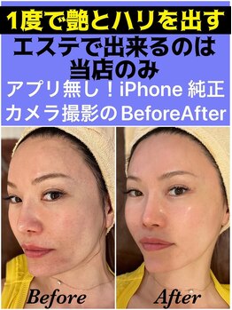 スペチアーレ 夙川/ピーリングは古い!最新マシン