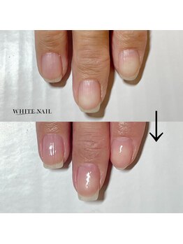 ホワイトネイル 武蔵小杉店(WHITE NAIL)/ネイルケア・自爪育成・爪育