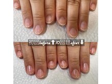 ネイルサロン ユーズ(USE.)/最強のネイルケア/自爪育成