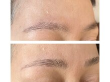 クラージュ(Courage)/眉毛とお顔脱毛お得セット