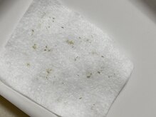 天使の毛穴 岐阜羽島店の雰囲気（頑固な毛穴の黒ずみ汚れ、全て取り除きます！お任せください）