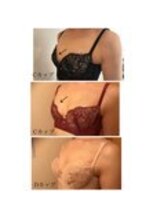 美人バスト 表参道店/【バストアップ/育乳 症例】