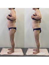 キアラ(chiara)/ 50代２ヶ月後