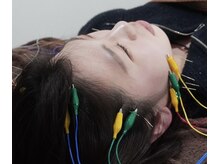 リベルタ鍼灸整骨院 なんば店(Liberta鍼灸整骨院)/美容鍼/食いしばり・眼精疲労に!