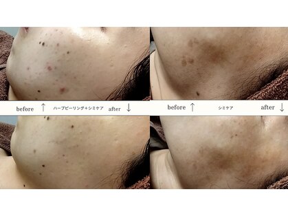 サロン ピューパ(Salon pupa)の写真