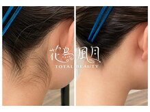 花鳥風月トータルビューティーの雰囲気（自分ではケアしづらく、人から見れる背面はプロにおまかせ！）