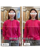 ビュースタイル川西/前後の変化が◎