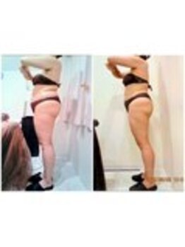 パーフェクトボディプレミアム 渋谷店(PERFECT BODY PREMIUM)/お客様 ビフォーアフター(25)