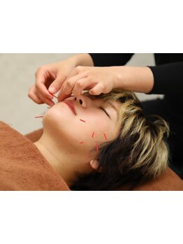 小顔になりたい