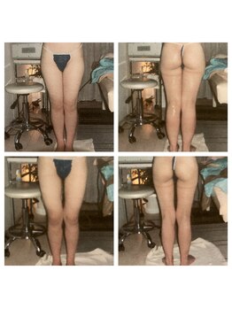 ローザー トウキョウ(Lowther Tokyo)/諦めないダイエット