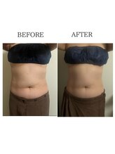 ワン ストレッチ(ONE stretch)/【ウエスト】