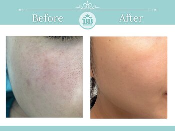 ゼロ美人 那覇店(ZERO美人)/【シミケア★シミケアZERO美人】