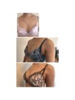 美人バスト 表参道店/【バストアップ/育乳 症例】