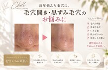 チル(Chill)
