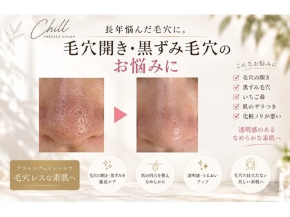 チル(Chill)の写真